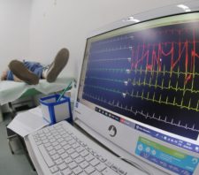 Saúde realiza 263 procedimentos de eletrocardiograma