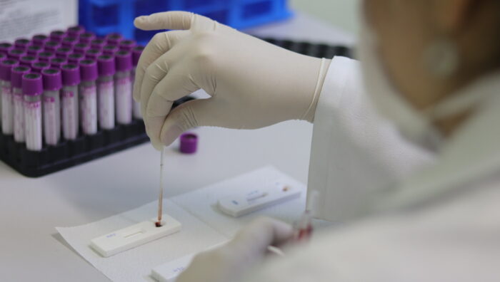 Saúde inicia ‘Julho Amarelo’ com ações contra hepatite nos postos