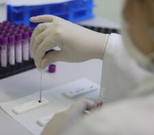 Secretaria de Saúde reforça orientações sobre hepatites virais
