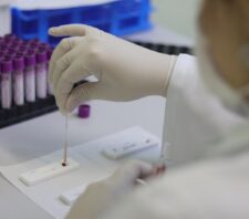 USFs recebem ações sobre hepatites virais durante ‘Julho Amarelo’